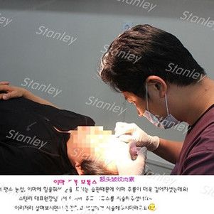 李恩锡玻尿酸除皱