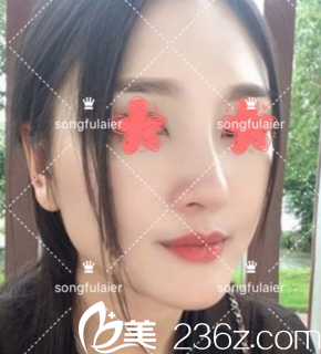 术后一周 术后一周