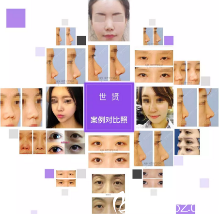 世贤修复案例展示 世贤修复案例展示