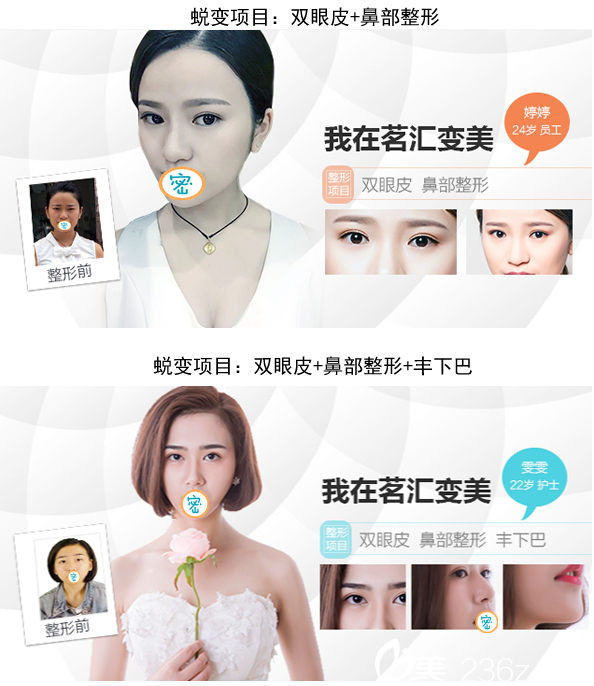 绵阳茗汇医疗美容医院部分塑美案例 绵阳茗汇医疗美容医院部分塑美案例