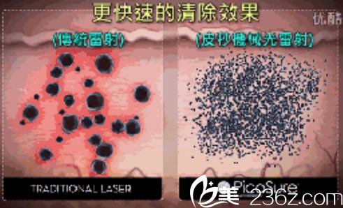 皮秒祛斑祛斑<span style= 皮秒祛斑祛斑<span style=