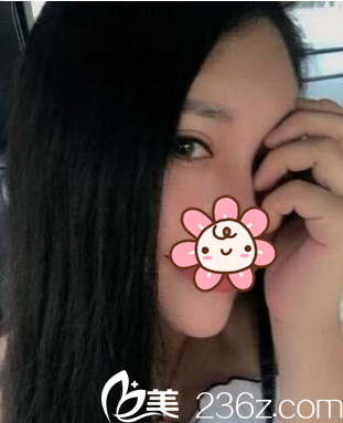 33天了，来个侧面照