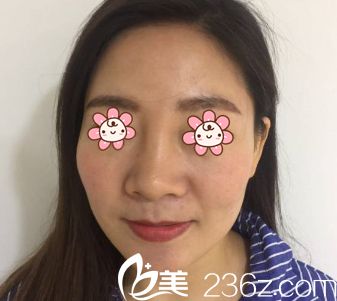 金善球院长让护士帮我拍的术前照 金善球院长让护士帮我拍的术前照