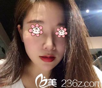 术后31天 术后31天