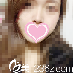 术后一个月情况