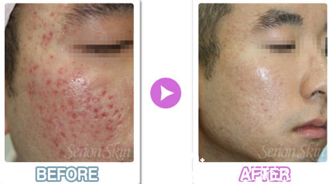 医院真人案例 医院真人案例