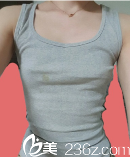 这就我去遵义利美康整形做胸之前的样子 这就我去遵义利美康整形做胸之前的样子