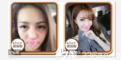 北京壹加壹医疗美容门诊部案例 北京壹加壹医疗美容门诊部案例