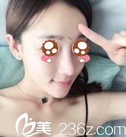 南阳维多利亚隆鼻后半个月