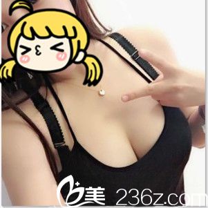 赣州俪人整形医院真人案例