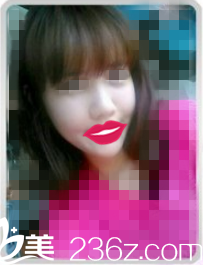 术后半个月恢复情况 术后半个月恢复情况