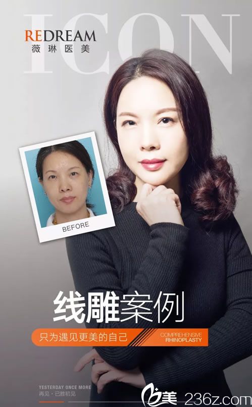 宁波薇琳王中秒医生<span style=