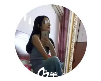 术后一个月效果