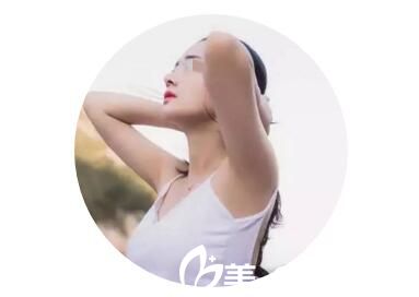 术后四个月恢复效果