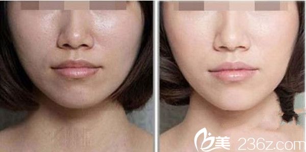 徐云泳皮肤美白案例