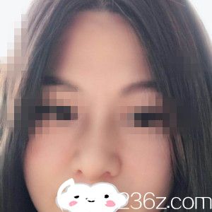 术后一周 术后一周