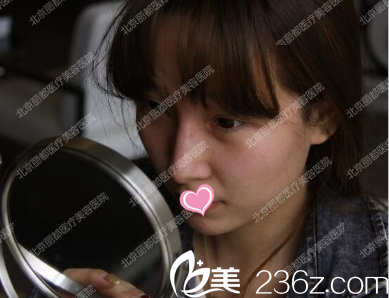 注射后当天照片