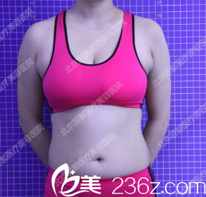 北京米兰柏羽丽都医疗美容医院案例术前照 北京米兰柏羽丽都医疗美容医院案例术前照