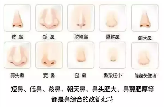 南宁隆鼻哪家医院好？南宁陈炳俊鼻综合手术19000元起塑美鼻