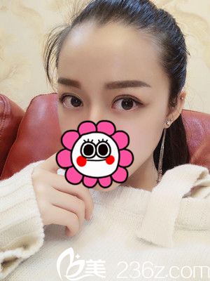 术后一个月效果