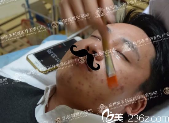 维多利亚果酸治疗青春痘过程 维多利亚果酸治疗青春痘过程