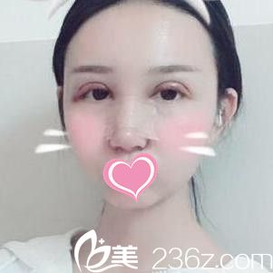 术后3天 术后3天