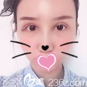 术后一周 术后一周