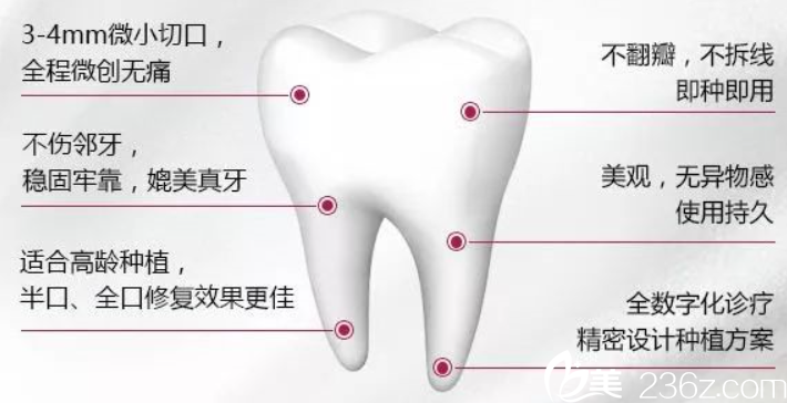 贵州利美康种植牙优势 贵州利美康种植牙优势