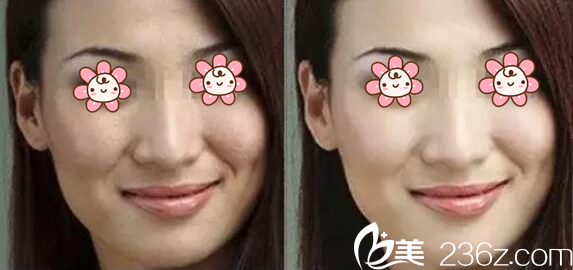 黄爱文主任案例 黄爱文主任案例