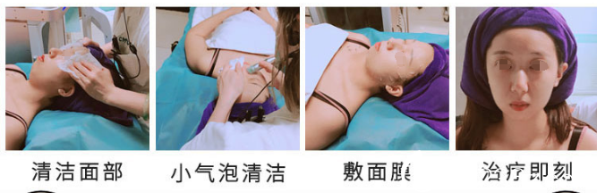 在无锡同舟整形做韩国小气泡