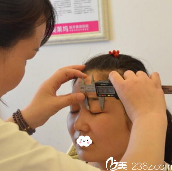 淮北微悦（伊尔美）医疗美容门诊部双眼皮术前测量