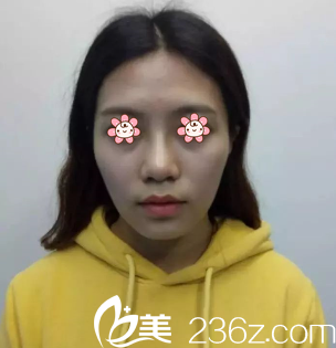 术前的我 术前的我