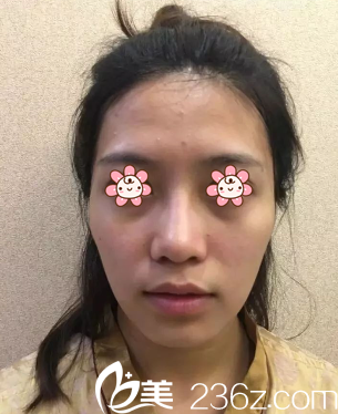 闺蜜介绍我去了重庆时光整形美容医院面诊 闺蜜介绍我去了重庆时光整形美容医院面诊