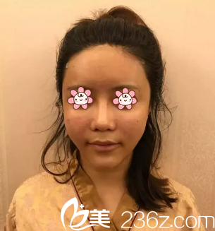 术后即刻 术后即刻