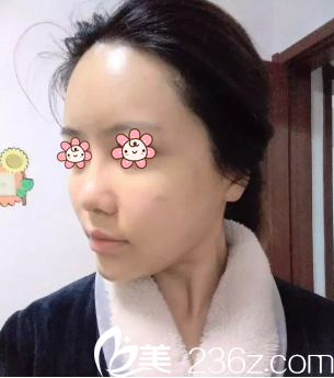 范眉清医生给我做完第二天 范眉清医生给我做完第二天