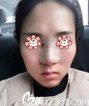 单磊医生给我做完手术后第二天 单磊医生给我做完手术后第二天