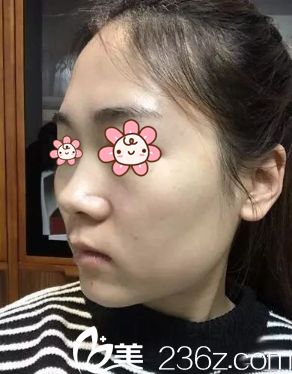 这是我去重庆华美整形美容医院之前拍的 这是我去重庆华美整形美容医院之前拍的