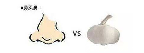 什么是蒜头鼻