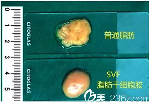 壹加壹SVF脂肪胶