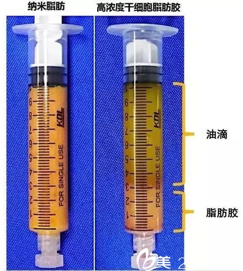 脂肪胶和传统脂肪不同之处