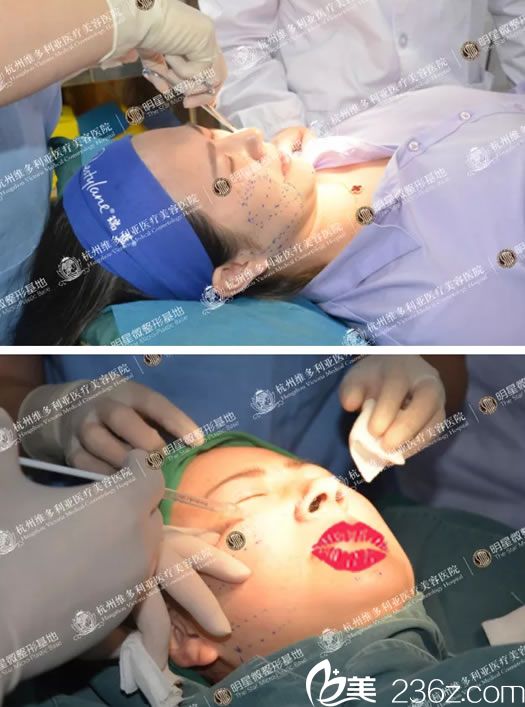 维多利亚面部线雕麻醉过程
