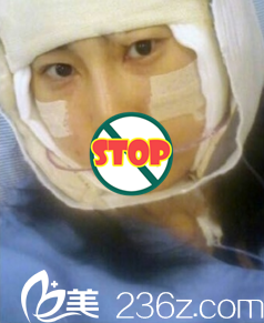 面部轮廓整形天照