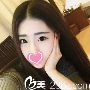 <!--<i data=20240703-sp></i>-->皮肤病美容整形专科医院双眼皮手术案例 <!--<i data=20240703-sp></i>-->皮肤病美容整形专科医院双眼皮手术案例