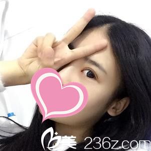 术后14天 术后14天