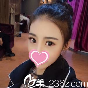 术后50天 术后50天