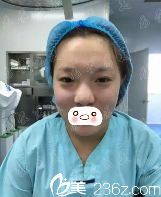 术前照片 术前照片