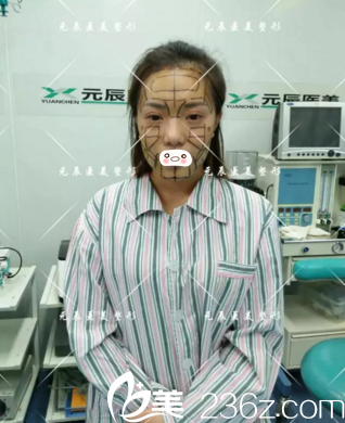 术前设计划线 术前设计划线