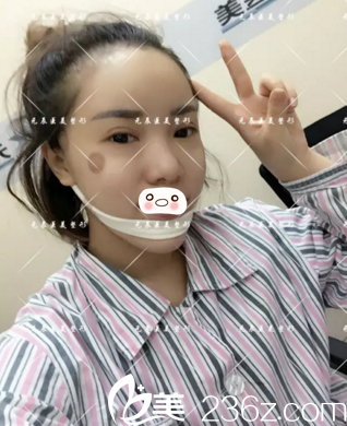 术后第二天情况 术后第二天情况