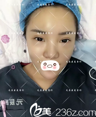 第三天情况 第三天情况