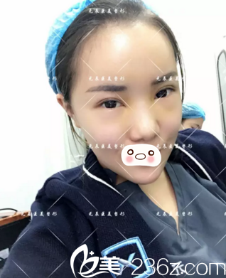 第五天恢复情况 第五天恢复情况